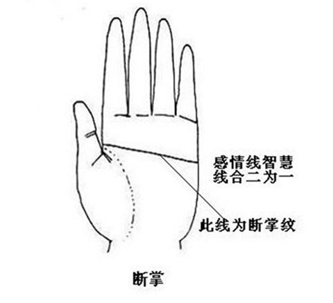 断掌