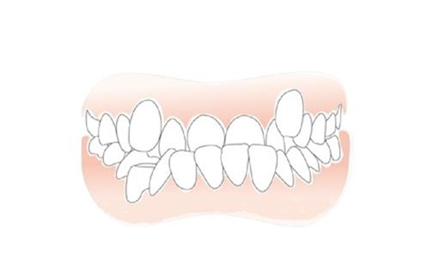 麪相牙齒不齊