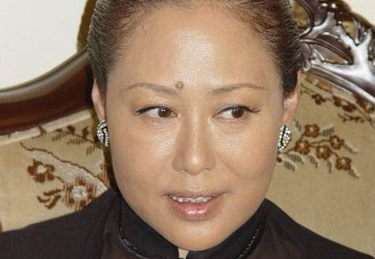 女人痣相大全，上停痣相解析