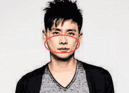 鼻子歪