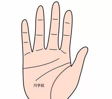 川字纹消除