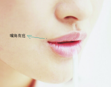 女人10処有痣是富貴痣