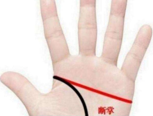 手相断掌