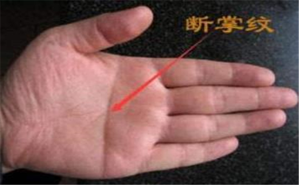 刘诗诗断掌