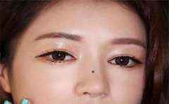 旺夫相的女人痣虽然多,但是这个最常见