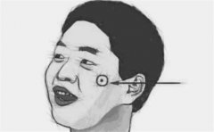 痣的面相图,这种痣相的解读有多方面,好坏参