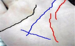 岛纹不详 不论出现在哪 运势都会受破坏