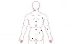 看全身痣相,七星痣命运