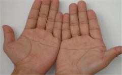 双手断掌纹，断掌纹的运势情况