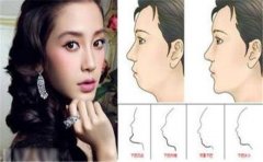 有这种心善的面相，好人有好报