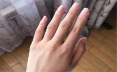 手很干瘪的人一定要在这些方面有所注意