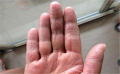 中指很长及其相关中指手相分析，与你想象的有