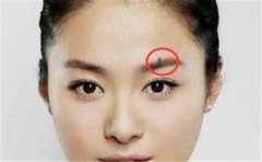 这样的痣是吉痣,位置别搞错了,不然就尴尬了