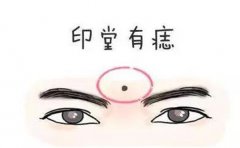 眉毛之间有痣的男人事业易受阻,找对方法解决