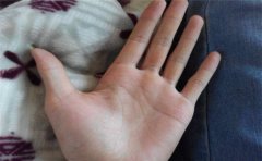 有这样的细纹就是有横财手相