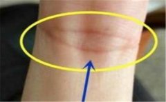 这个才是夫子眼手相，很多人会一不小心就搞错