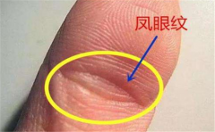 有凤眼纹手相图解的人非常浪漫，而这些人恰恰