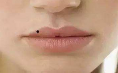 不健康痣相都有这些，赶紧来看看