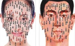 倒霉痣非常多，一不留意就中招，有它的人容易