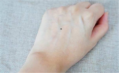 解读男人手背痣相运势