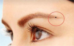 帝王痣相的象征,有这种痣相有权有势