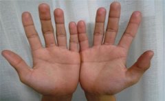 <b>这是婚姻线，不了解的人赶紧来学习一下，好处</b>