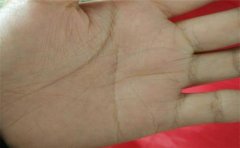 生命线掌纹特征多，这些特征应该重点关注