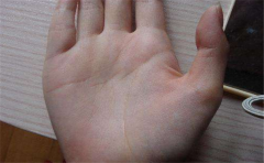 两指斗纹的意义