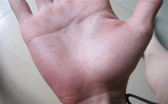 女子断掌克夫 听听手相大师怎么说