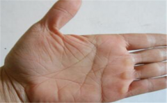 女人断掌纹运势情况分析