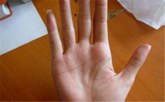 手相的岛纹对运势所产生的影响