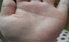 漏财手相见过不少，其中这个的情况最严重