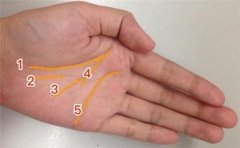 男断掌手相情况多变，需要具体手相具体分析