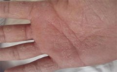 有挣大钱手相的人，上辈子可能是拯救了宇宙，