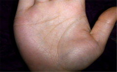 通天纹手相运势特征分析