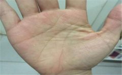 手相感情线看爱情观，不同的态度造就不同的运