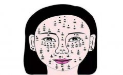 从孩子痣相看人生，这种痣前途不可限量