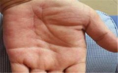 财运线弯曲寓意不好，主要都有这些方面的体现