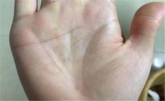 有劳碌命手相的人命运悲惨，但也有程度轻重之