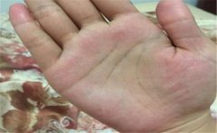 掌心凹陷手相运势分析，基本上都是很好的运势