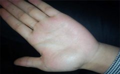 贵人纹手相运势如何分析