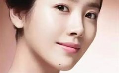 女人下巴痣相含义多，主要跟位置有关，别弄错