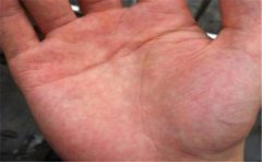 常见的几种穷人手相