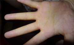 手相看婚姻，看看这些手相的女人婚姻运如何