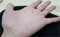 教你怎么看手相桃花劫，不懂的赶紧学习