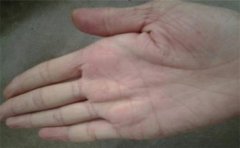 无名指看命运，这些手相特征很多人都会有