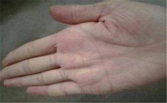 智慧线图解大全,看看这些智慧线特征你有没有