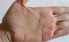 揭秘离婚和丧偶手相，这种手相容易单身