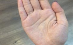 手相很罕见，出现一种恭喜你要发财了