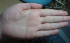 解析手相三条婚姻线，这样的特征其实很常见